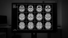 Nejnebezpečnější jídlo pro mozek