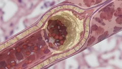 O této účinnosti vysoké hladiny cholesterolu jste nevěděli